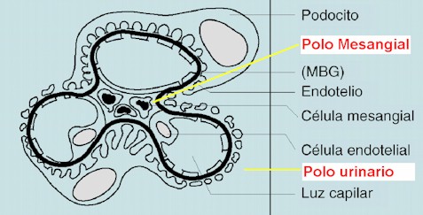 glomerulonefritis_aguda glomerulonefritis_aguda