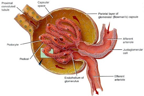 glomerulonefritis_aguda_anatomia