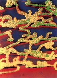 glomerulonefritis_aguda_estrepcoco_beta_hemolitico glomerulonefritis_aguda_estrepcoco_beta_hemolitico