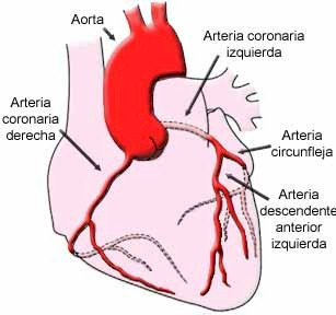 iam_arterias_coronarias iam_arterias_coronarias