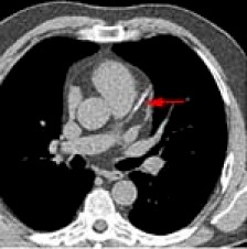 tomografia_axial_helicoidal tomografia_axial_helicoidal
