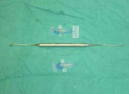 injerto_gingival_libre10 injerto_gingival_libre10
