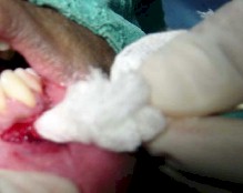 injerto_gingival_libre4 injerto_gingival_libre4