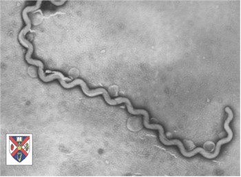 leptospirosis_leptospira leptospirosis_leptospira