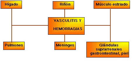 leptospirosis_sindrome_weil