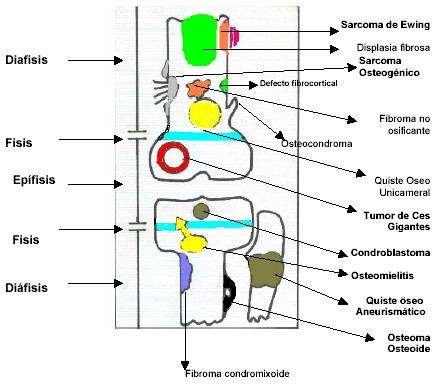 localizacion_radiologica