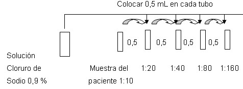 microalbuminuria_tecnica microalbuminuria_tecnica