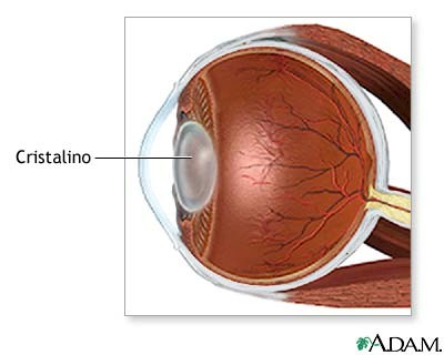 oftalmologia_cataratas