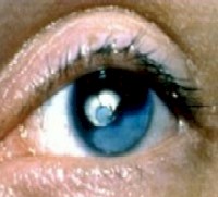 oftalmologia_examen_fisico