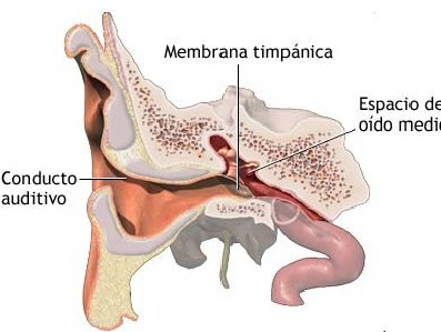 otitis_oido_medio