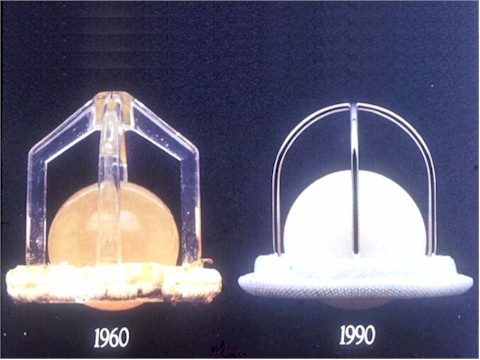 protesis_valvulares_valvula_Starr_Edwards2