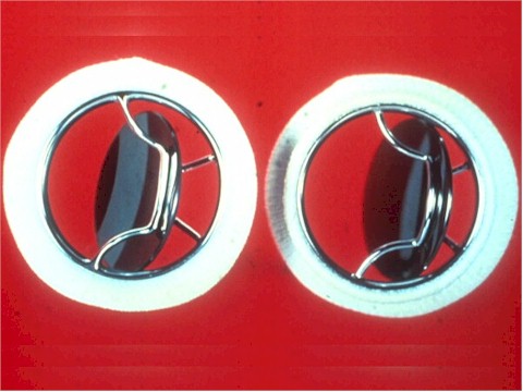 protesis_valvulares_valvula_monodisco protesis_valvulares_valvula_monodisco