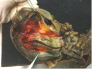 intususcepcion_colocolica_volvulo_sigmoides intususcepcion_colocolica_volvulo_sigmoides