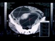 CT_scan1
