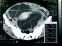 CT_scan2