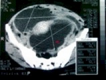 CT_scan2 CT_scan2