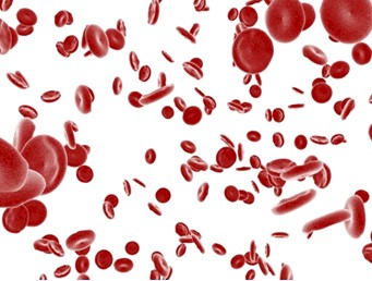 talasemia_Enfermería_anemia/sangre_hematies_microscopio