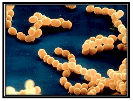 germenes_dialisis_peritoneal/bacteria_Estreptococo_viridans