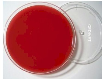 germenes_dialisis_peritoneal/cultivo_agar_sangre