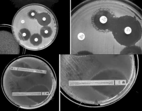 germenes_dialisis_peritoneal/sensibilidad_bacteriana_in-vitro