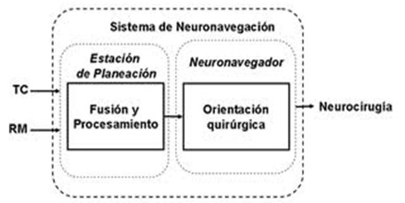 neuronavegacion_neurociencias/funcionamiento_sistema_neuronavegador