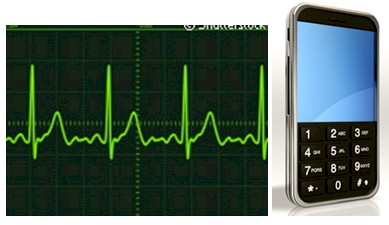 cardiocellphone-cardiologia-movil/ECG-electrocardiograma